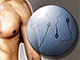 Male Infertility