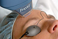 Laser Resurfacing