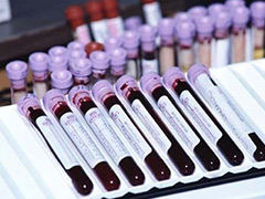 Cholesterol Blood Test