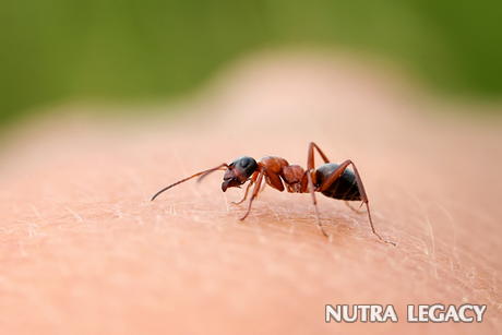 Ant Bites Treatment