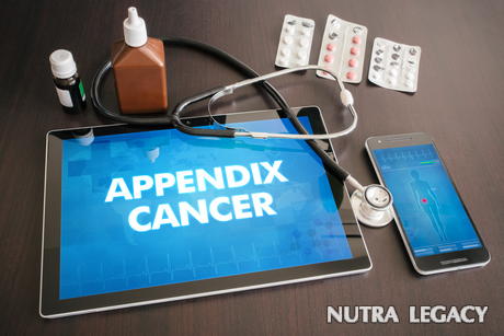 What Is Appendix Cancer