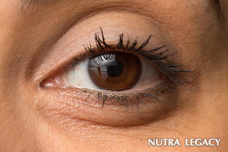 Glaucoma Natural Treatment