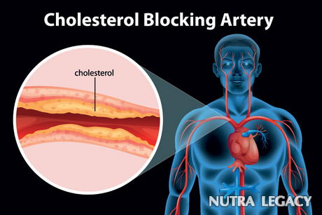 Lowering Cholesterol Without Statins