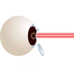 Custom Lasik Surgery