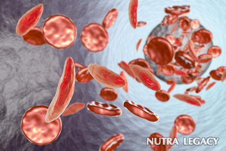 5 Interesting Facts about Sickle Cell Disease