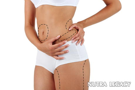 Liposuction Before And After