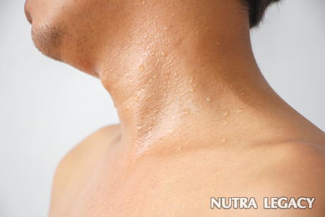 Causes of Sweating Causes of Sweating