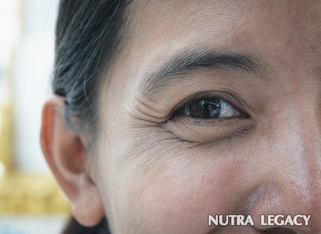 Dark Circles Under Eyes