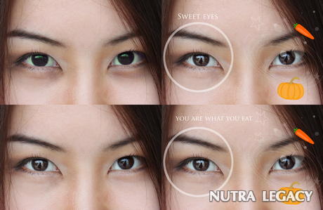 Dark Circles Under Eyes