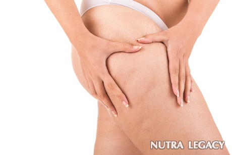Natural Cellulite Treatments