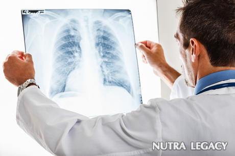 Viral Pneumonia