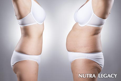 Liposuction Alternatives