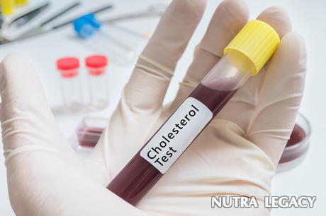 Normal cholesterol levels