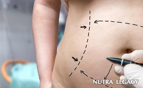 Non-invasive Liposuction