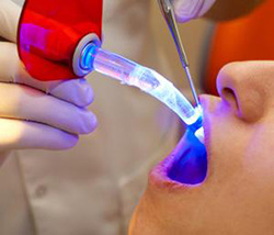 Laser Periodontal Surgery