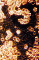 Viscosity of the Blood