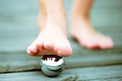 Topical Pain Relievers